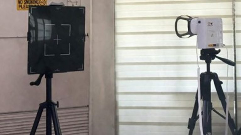 PCSO Brings NASA-Tested Portable AI X-Ray Technology To Batanes
